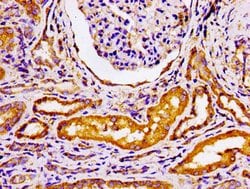 Invitrogen GRK3 Polyclonal Antibody 100 &mu;g; Unconjugated:Antibodies,