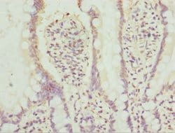 Invitrogen AGPAT2 Polyclonal Antibody 100 &mu;L; Unconjugated:Antibodies,