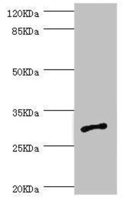 Invitrogen AGPAT2 Polyclonal Antibody 100 &mu;L; Unconjugated:Antibodies,