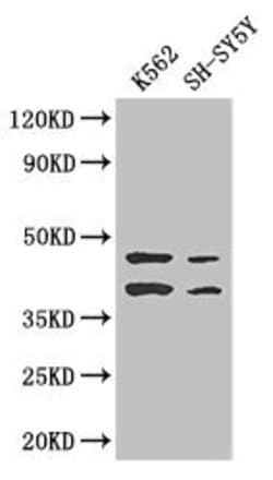 Invitrogen AIM2 Polyclonal Antibody 100 &mu;g; Unconjugated:Antibodies,