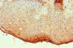 Invitrogen ALOX15B Polyclonal Antibody 100 μL; Unconjugated:Antibodies,