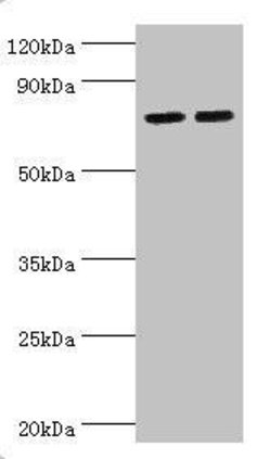Invitrogen ALOX15B Polyclonal Antibody 100 μL; Unconjugated:Antibodies,