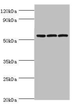 Invitrogen alpha Amylase 2B Polyclonal Antibody 100 μL; Unconjugated:Antibodies,