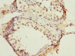 Invitrogen CMG2 Polyclonal Antibody 100 μL; Unconjugated:Antibodies,