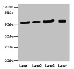 Invitrogen CMG2 Polyclonal Antibody 100 μL; Unconjugated:Antibodies,