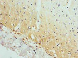 Invitrogen AP2A2 Polyclonal Antibody 100 &mu;L; Unconjugated:Antibodies,