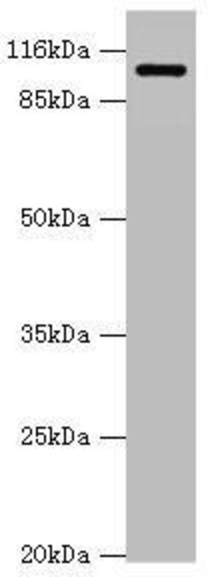 Invitrogen AP2A2 Polyclonal Antibody 100 &mu;L; Unconjugated:Antibodies,