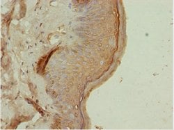 ATMIN Polyclonal Antibody:Anticuerpos