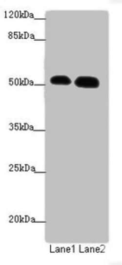 ATMIN Polyclonal Antibody:Anticuerpos