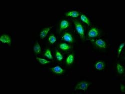 Invitrogen BCL-3 Polyclonal Antibody 100 &mu;g; Unconjugated:Antibodies,