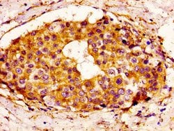 Invitrogen BCL-3 Polyclonal Antibody 100 &mu;g; Unconjugated:Antibodies,