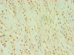 Invitrogen BLK Polyclonal Antibody 100 &mu;L; Unconjugated:Antibodies,