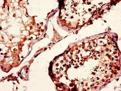 Invitrogen CD37 Polyclonal Antibody 100 &mu;g; Unconjugated:Antibodies,