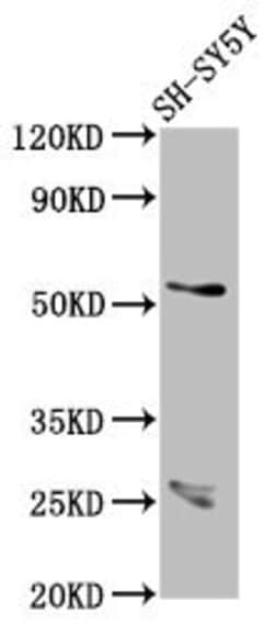 Invitrogen CDR2L Polyclonal Antibody 100 &mu;g; Unconjugated:Antibodies,