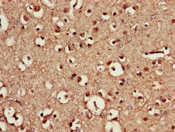 Invitrogen CDX4 Polyclonal Antibody 100 &mu;g; Unconjugated:Antibodies,