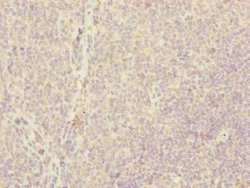 Invitrogen CENPH Polyclonal Antibody 100 μL; Unconjugated:Antibodies,