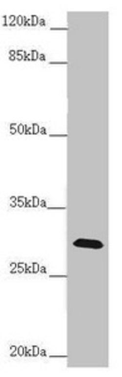 Invitrogen CENPH Polyclonal Antibody 100 μL; Unconjugated:Antibodies,