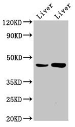 CHKB Polyclonal Antibody 100 &mu;g | Buy Online | Thermo Scientific | Fisher Scientific