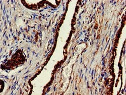 Invitrogen ENTH Polyclonal Antibody 100 &mu;g; Unconjugated:Antibodies,