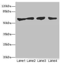Invitrogen CLK1 Polyclonal Antibody 100 &mu;L | Buy Online | Invitrogen&trade; | Fisher Scientific