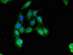 Invitrogen Calponin 3 Polyclonal Antibody 100 &mu;g; Unconjugated:Antibodies,