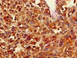 Invitrogen Calponin 3 Polyclonal Antibody 100 &mu;g; Unconjugated:Antibodies,