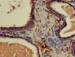Invitrogen Calponin 3 Polyclonal Antibody 100 &mu;g; Unconjugated:Antibodies,