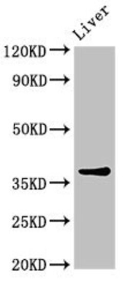 Invitrogen Calponin 3 Polyclonal Antibody 100 &mu;g; Unconjugated:Antibodies,