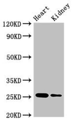 Invitrogen CSH2 Polyclonal Antibody 100 &mu;g; Unconjugated:Antibodies,