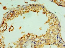 Invitrogen Cathepsin V Polyclonal Antibody 100 &mu;L; Unconjugated:Antibodies,