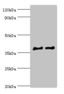 Invitrogen Cathepsin V Polyclonal Antibody 100 &mu;L; Unconjugated:Antibodies,