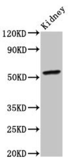Invitrogen CYP2C19 Polyclonal Antibody 100 &mu;g; Unconjugated:Antibodies,