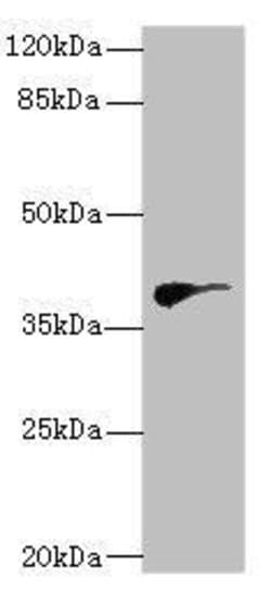 Invitrogen DHDDS Polyclonal Antibody 100 &mu;L; Unconjugated:Antibodies,