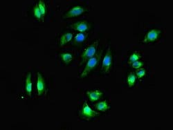 Invitrogen DHRS3 Polyclonal Antibody 100 &mu;g; Unconjugated:Antibodies,