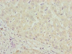 Invitrogen DHRS3 Polyclonal Antibody 100 &mu;g; Unconjugated:Antibodies,