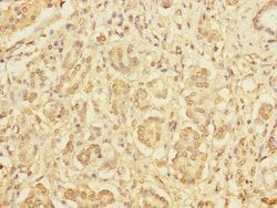 Invitrogen DIAPH2 Polyclonal Antibody 100 μL; Unconjugated:Antibodies,