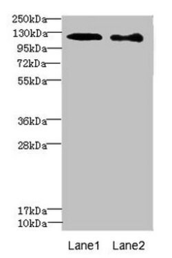 Invitrogen DIAPH2 Polyclonal Antibody 100 μL; Unconjugated:Antibodies,