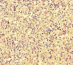 Invitrogen DOK2 Polyclonal Antibody 100 &mu;g; Unconjugated:Antibodies,
