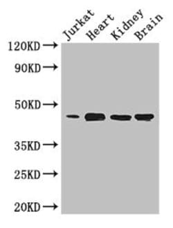 Invitrogen DOK2 Polyclonal Antibody 100 &mu;g; Unconjugated:Antibodies,