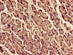 Invitrogen DPM1 Polyclonal Antibody 100 &mu;g; Unconjugated:Antibodies,