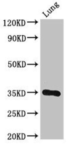 Invitrogen DPM1 Polyclonal Antibody 100 &mu;g; Unconjugated:Antibodies,