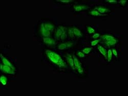 Invitrogen EGR2 Polyclonal Antibody 100 &mu;g; Unconjugated:Antibodies,