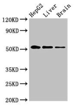 Invitrogen EGR2 Polyclonal Antibody 100 &mu;g; Unconjugated:Antibodies,