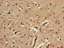 Invitrogen EphA5 Polyclonal Antibody 100 &mu;g; Unconjugated:Antibodies,
