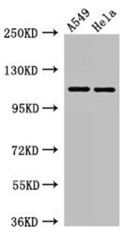 Invitrogen EphA5 Polyclonal Antibody 100 &mu;g; Unconjugated:Antibodies,