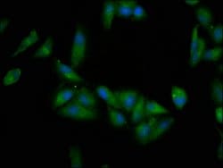 Invitrogen EPRS Polyclonal Antibody 100 μg; Unconjugated:Antibodies,