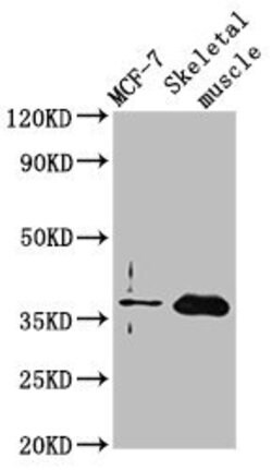 Invitrogen FBP2 Polyclonal Antibody 100 μg; Unconjugated:Antibodies,