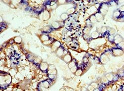 Invitrogen SHFM3 Polyclonal Antibody 100 μL; Unconjugated:Antibodies,