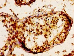 Invitrogen FGF17 Polyclonal Antibody 100 μg; Unconjugated:Antibodies,