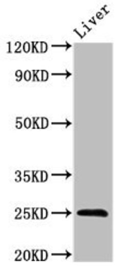 Invitrogen FGF17 Polyclonal Antibody 100 μg; Unconjugated:Antibodies,
